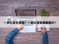 一串红常见病害？一串红常见病害图片？