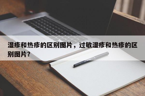 湿疹和热疹的区别图片，过敏湿疹和热疹的区别图片？-第1张图片-我家生活百科